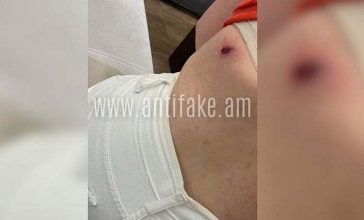 axjik-cucaarar_hPHe4.jpg