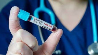 coronavirus-armenia_Fc3pv.jpg